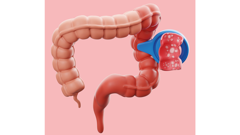 Darm &copy; Shutterstock