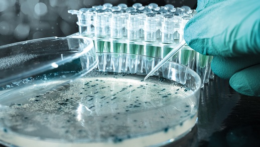 Petrischale E-coli-Bakterien © shutterstock