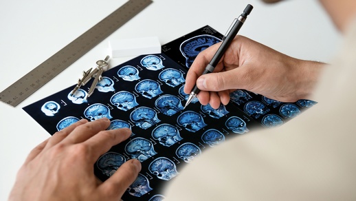 Multiple Sklerose © Shutterstock