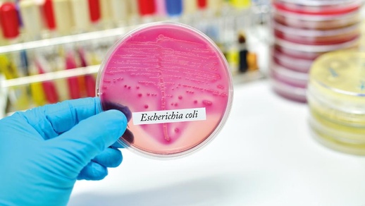 Zystitis © Shutterstock