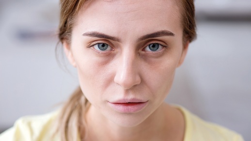 Eisenmangel © Shutterstock