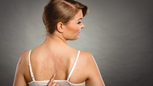 Haut © Shutterstock