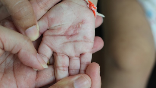 Permethrin © Shutterstock