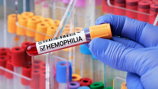 Hämophilie B © shutterstock