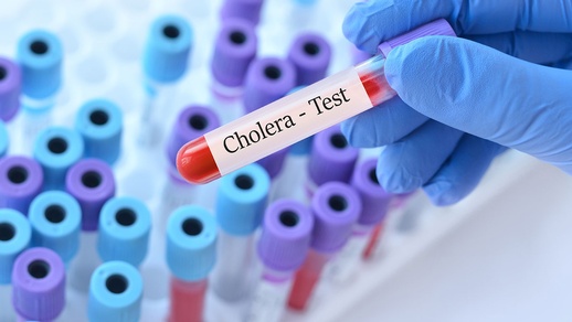Cholera-Test © Shutterstock
