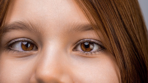 Mädchen schielt © Shutterstock