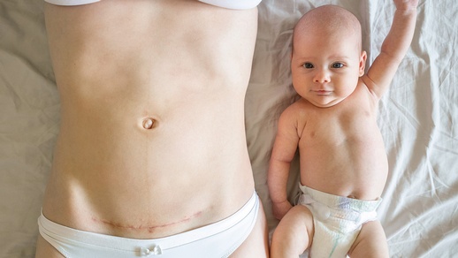 Schnitt © Adobestock