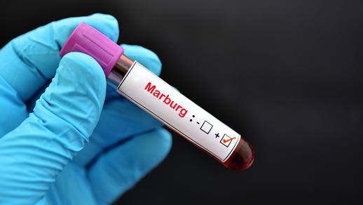 Marburg-Virus © Shutterstock