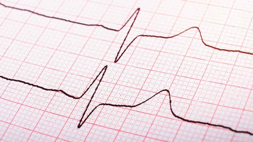 Hypertonie © Shutterstock