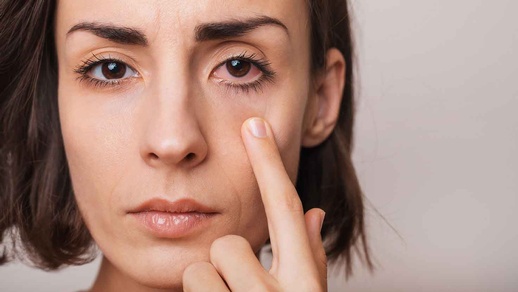 Rotes Auge © Shutterstock