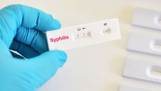 Syphilis © shutterstock