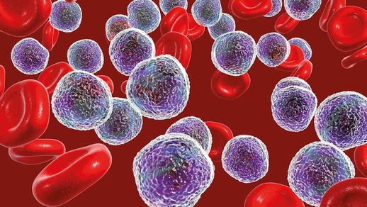 Leukämie © shutterstock