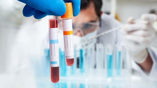 Cholesterinwerte messen © shutterstock