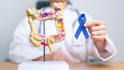 Darmkoloskopie © Shutterstock