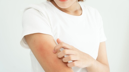 Hautpilz © Shutterstock