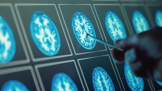 KI unterstützt bei OPs © Shutterstock