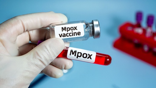MPOX © Shutterstock