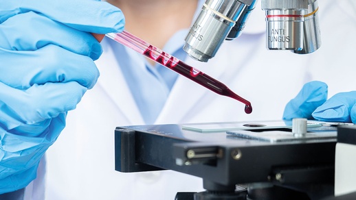 Blut wird mittels medizinischen Gerät analysiert. © iStock