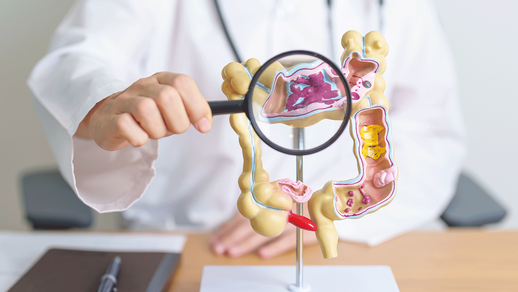 Neue Daten zeigen, dass Metformin seine zentrale Stoffwechselwirkung  direkt im intestinalen Epithel entfaltet. &copy;  iStockphoto