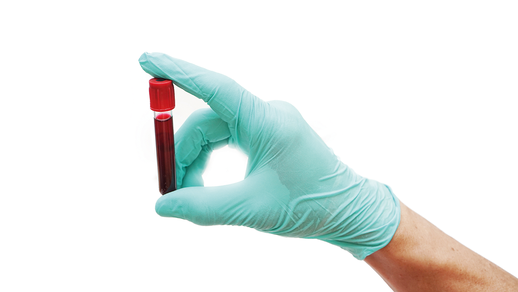 Blutprobe © Shutterstock