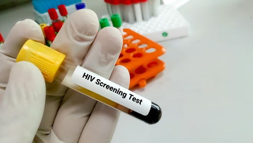 HIV Screening Test  © Shutterstock