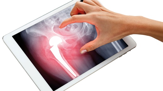 Tablet © Shutterstock