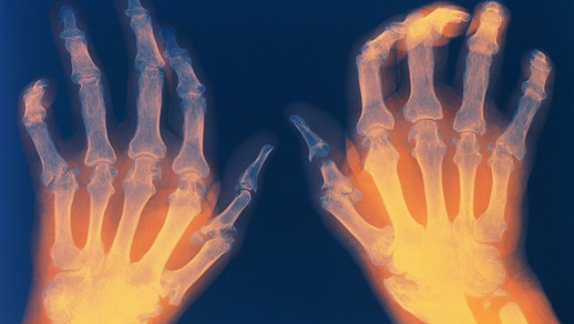 Röntgen der Hände © Shutterstock
