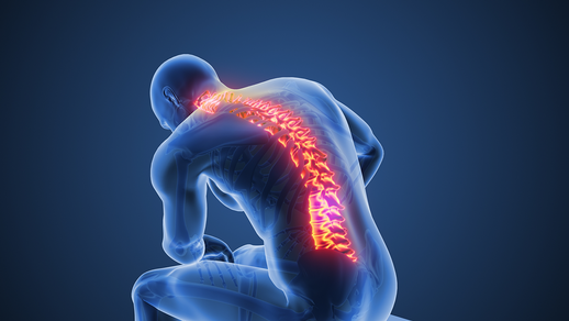 R&uuml;ckenschmerzen &copy; Shutterstock