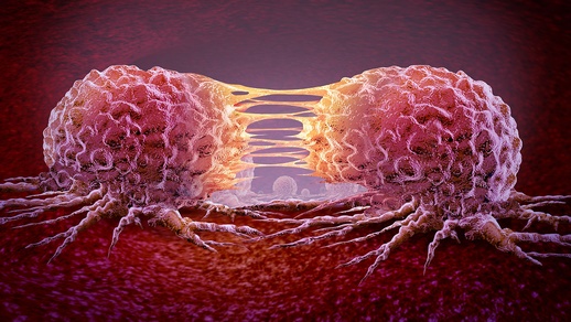 Metastasenbildung © shutterstock