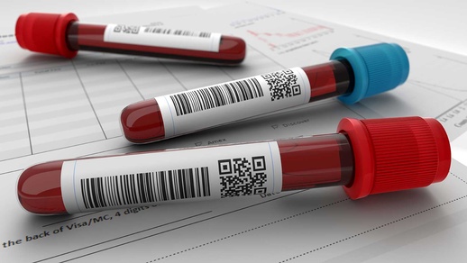 Blutproben © shutterstock