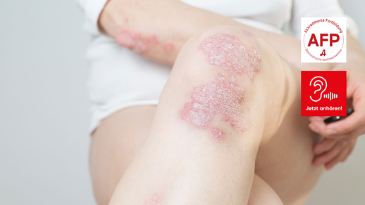 AFP_Audio170226 &copy; Shutterstock/APOVERLAG