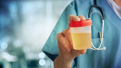 Harnprobe © shutterstock