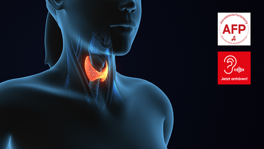 Tapazza &copy; Shutterstock/APOVERLAG