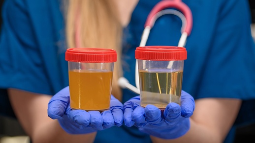 Urinprobe © shutterstock