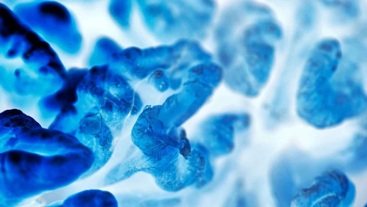 Tumor © Shutterstock