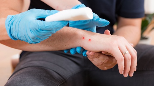 Schlangenbiss © shutterstock