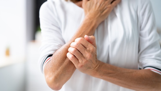 Symbolbild für Juckreiz. © Shutterstock