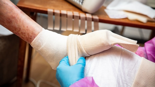 Das seltene Leiden Epidermolysis bullosa (EB) ist in der Öffentlichkeit besser aufgrund des Namens der betroffenen „Schmetterlingskinder“ als Schmetterlingskrankheit bekannt und beruht auf einer hereditär bedingten Hautbrüchigkeit. © Shutterstock