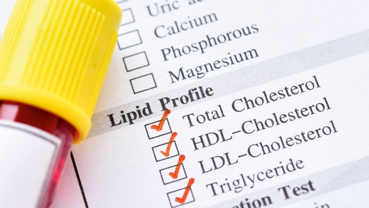 Atorvastatin senkt die LDL- und Triglyceridspiegel sowie das Gesamtcholesterin, während mit einem moderaten Anstieg des HDL zu rechnen ist. © Shutterstock