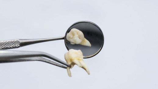 Zähne © Shutterstock