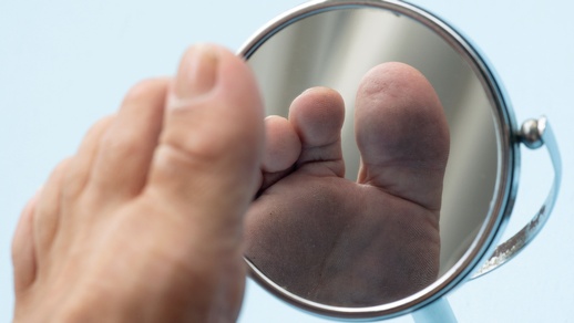 Bei der Untersuchung der Fußunterseite ist ein Spiegel hilfreich. © Shutterstock