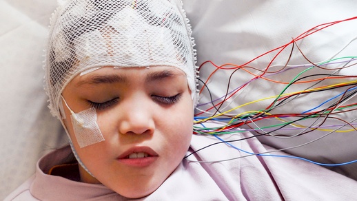 Themenbild Epilepsie bei Kindern © Shutterstock