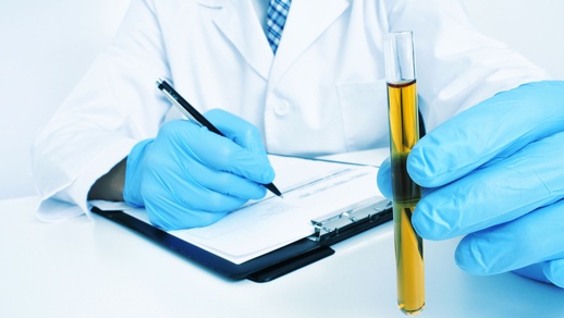 Arzt mit Urinprobe © Shutterstock