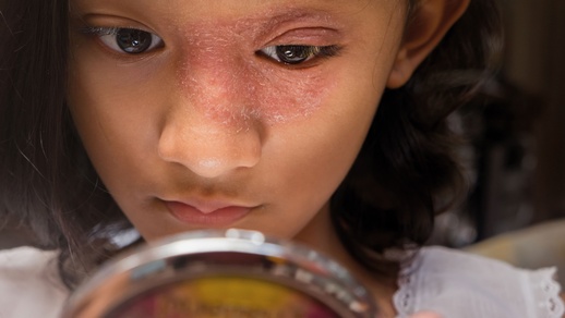 Doppelt gestraft: Zu den Beschwerden der Hautkrankheiten selbst kommen in vielen Fällen auch Stigmati­sierung und Scham. © Shutterstock