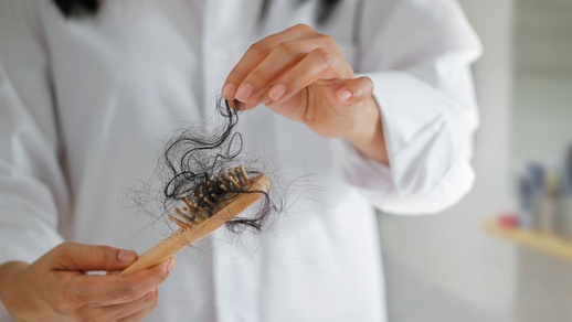 Ab einem länger andauernden Haarverlust von über 100 Haaren pro Tag spricht man von Haarausfall, der klinisch abgeklärt werden sollte.  © iStock