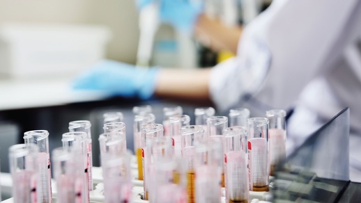 Reagenzgläser © Shutterstock