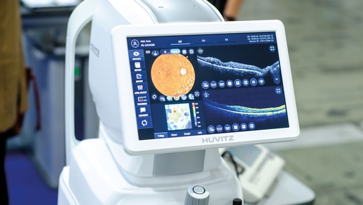 Optische Kohärenztomographie (OCT © Shutterstock