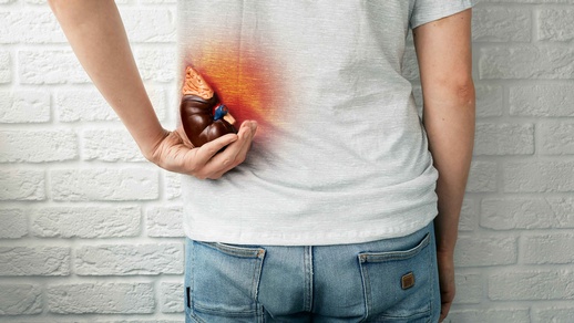 Daten von über 1 Million Personen wurden einbezogen, darunter rund 50.000 mit Nierensteinen.  © Shutterstock