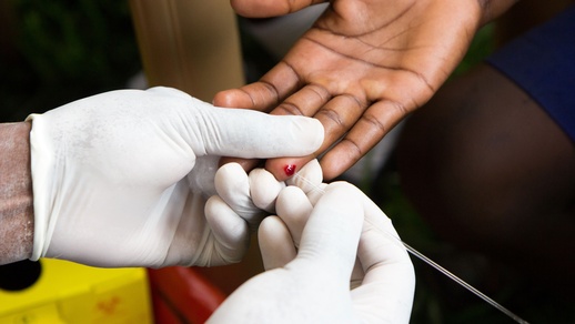 HIV-Test © Shutterstock