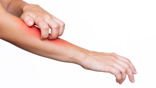 Symbolbild für Juckreiz © Shutterstock